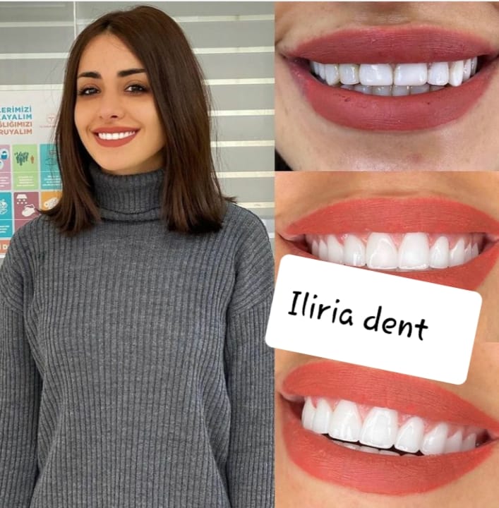 ____DENTISTE-NE-TIRANE-KLINIKE-102