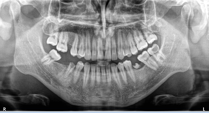 ___________________GRAFI-DENTARE-TIRANE-HIGJENA-13