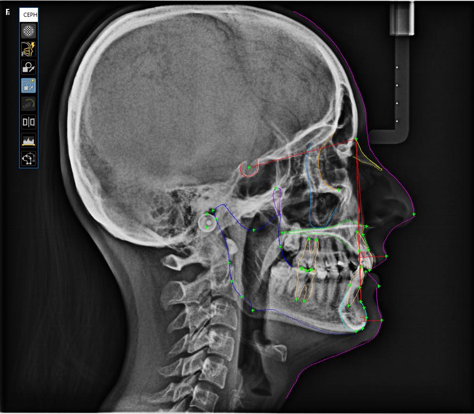 ___________________GRAFI-DENTARE-TIRANE-HIGJENA-14