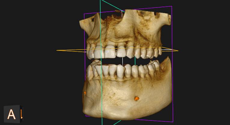 ___________________GRAFI-DENTARE-TIRANE-HIGJENA-16