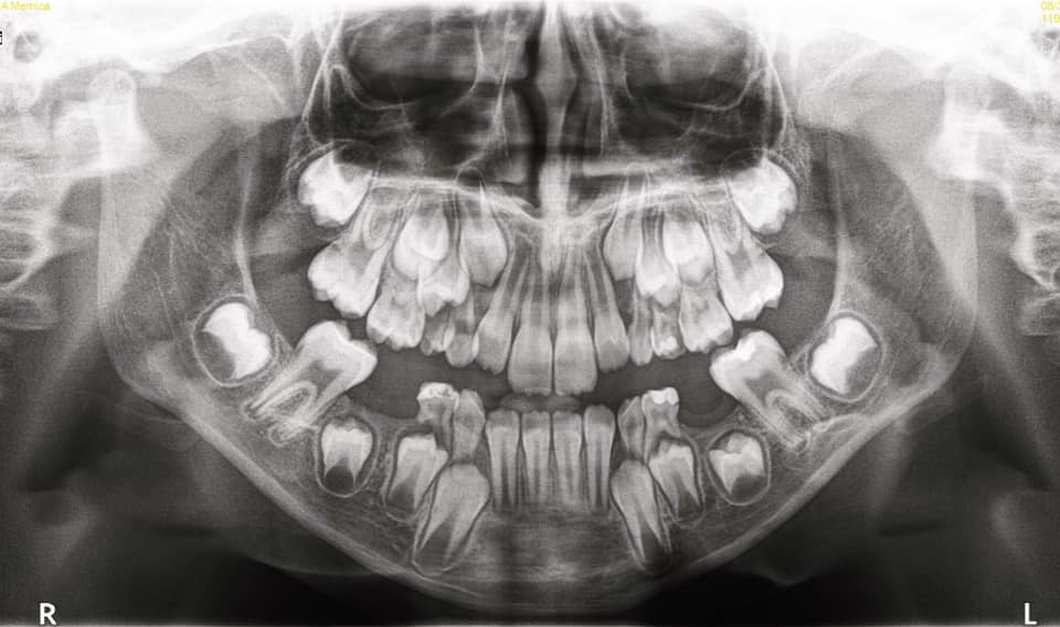 ___________________GRAFI-DENTARE-TIRANE-HIGJENA-17