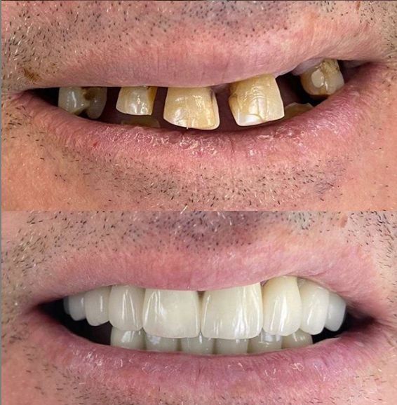 _________________Dentiste-durres-16