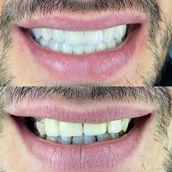 _________________Dentiste-durres-22