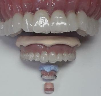 __________________Dentiste-durres-logo __________________Dentiste-durres-logo