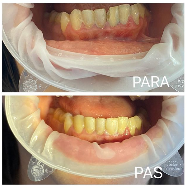 __dentiste-ne-tirane-14 __dentiste-ne-tirane-14