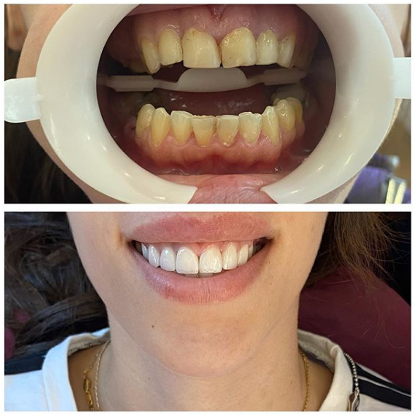 __dentiste-ne-tirane-141 __dentiste-ne-tirane-141