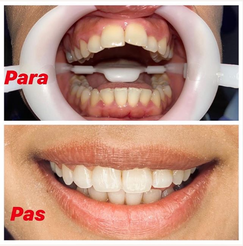 __dentiste-ne-tirane-15 __dentiste-ne-tirane-15