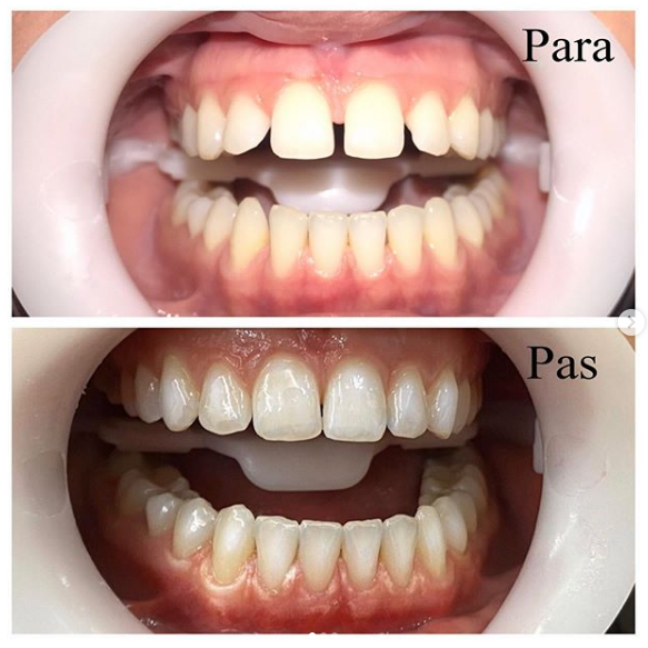 __dentiste-ne-tirane-152 __dentiste-ne-tirane-152