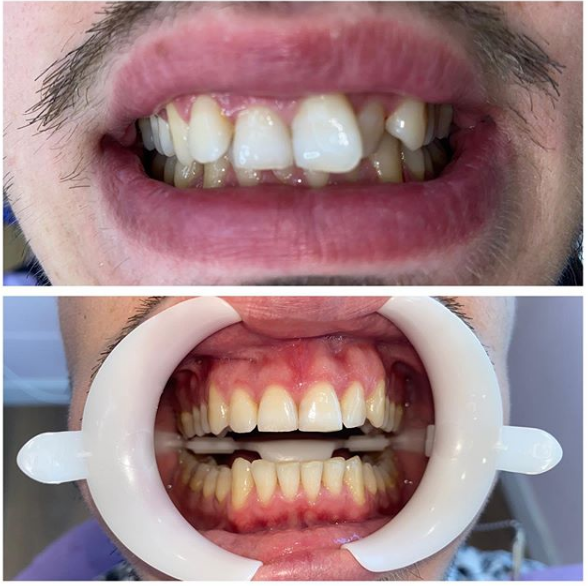 __dentiste-ne-tirane-16 __dentiste-ne-tirane-16