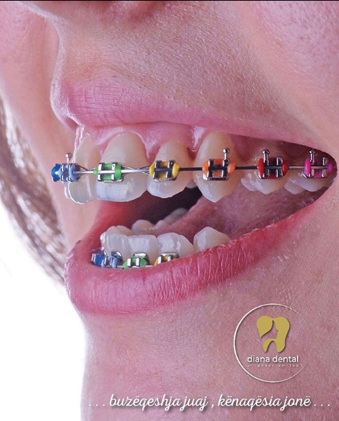 __dentiste-ne-tirane-17 __dentiste-ne-tirane-17