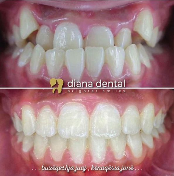 __dentiste-ne-tirane-18