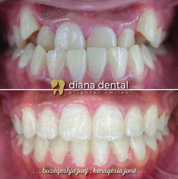 __dentiste-ne-tirane-18 __dentiste-ne-tirane-18