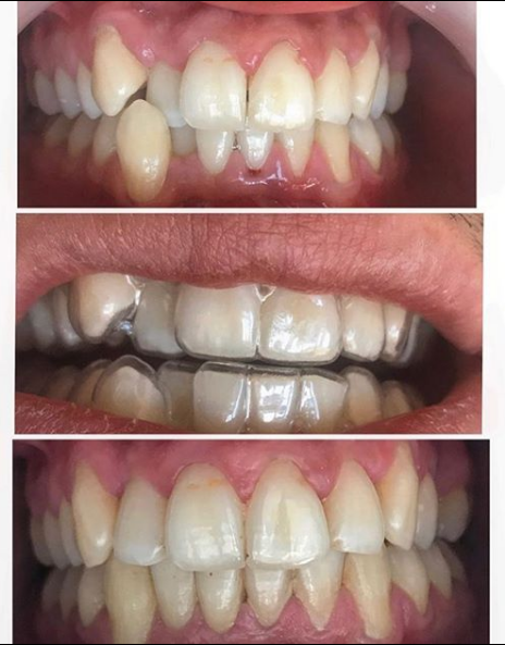 __dentiste-ne-tirane-19 __dentiste-ne-tirane-19