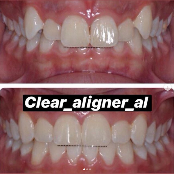 __dentiste-ne-tirane-99 __dentiste-ne-tirane-99