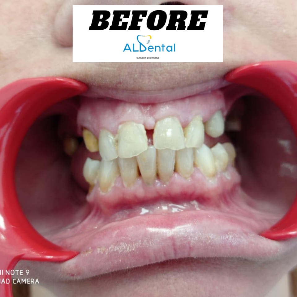 aldental-dentiste-16