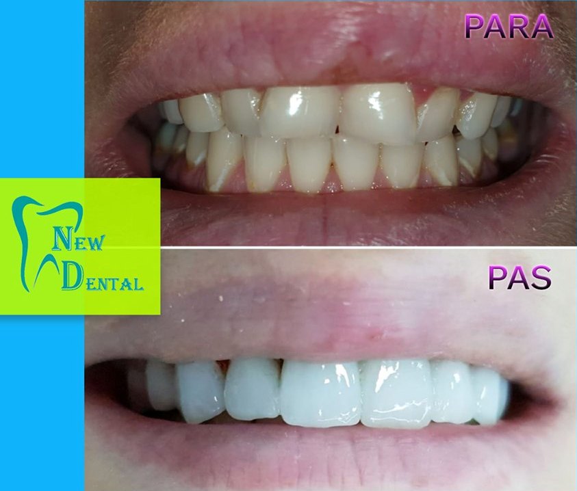 dental-new-klinike-tirana-17