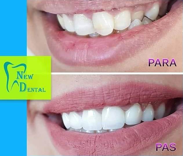 dental-new-klinike-tirana-21