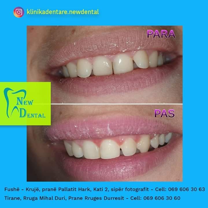 dental-new-klinike-tirana-25