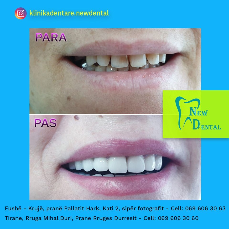 dental-new-klinike-tirana-26