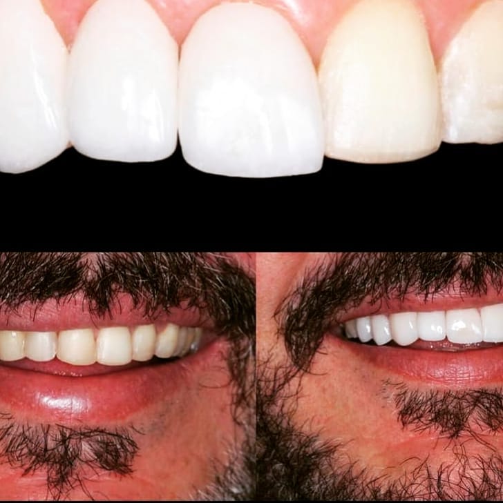 klinike-dentare-selite-10 klinike-dentare-selite-10