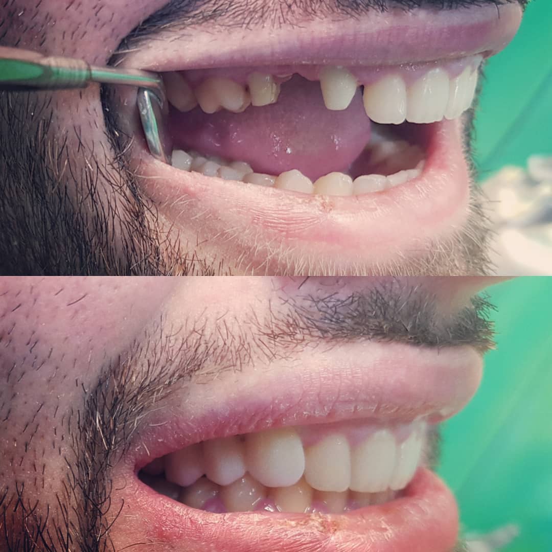 klinike-dentare-selite-12 klinike-dentare-selite-12