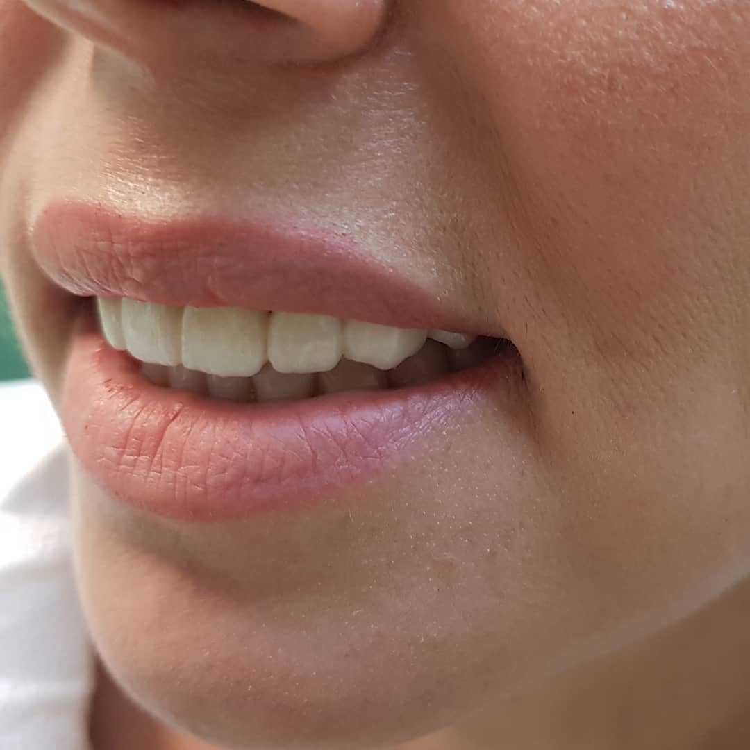 klinike-dentare-selite-14 klinike-dentare-selite-14