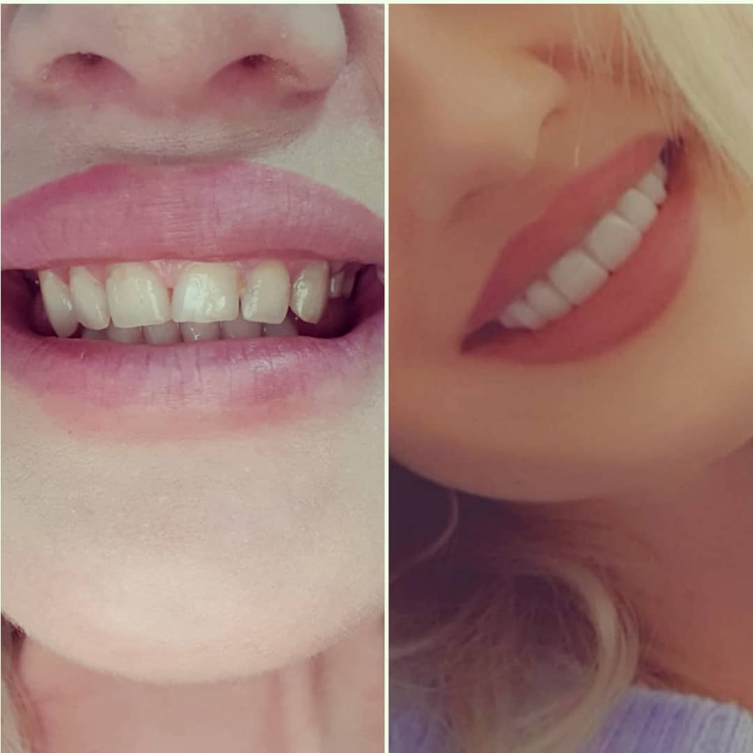 klinike-dentare-selite-15 klinike-dentare-selite-15