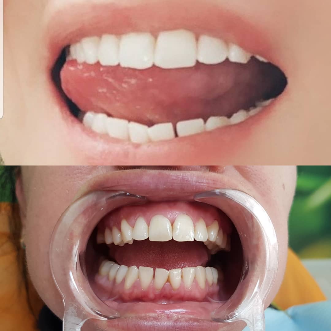 klinike-dentare-selite-16 klinike-dentare-selite-16
