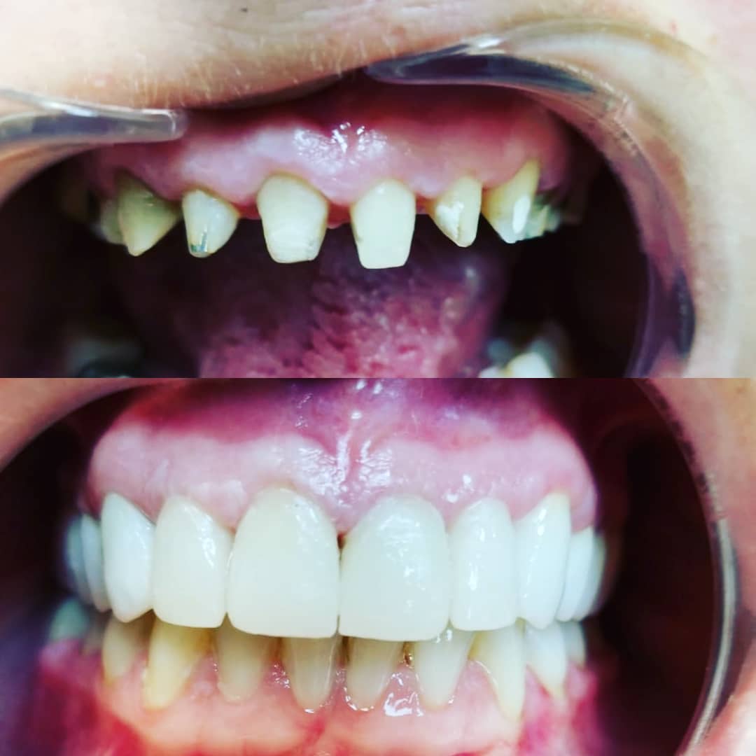 klinike-dentare-selite-17 klinike-dentare-selite-17