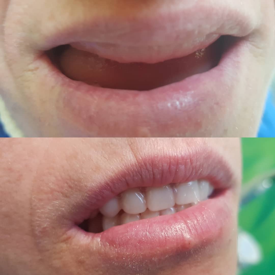 klinike-dentare-selite-18 klinike-dentare-selite-18