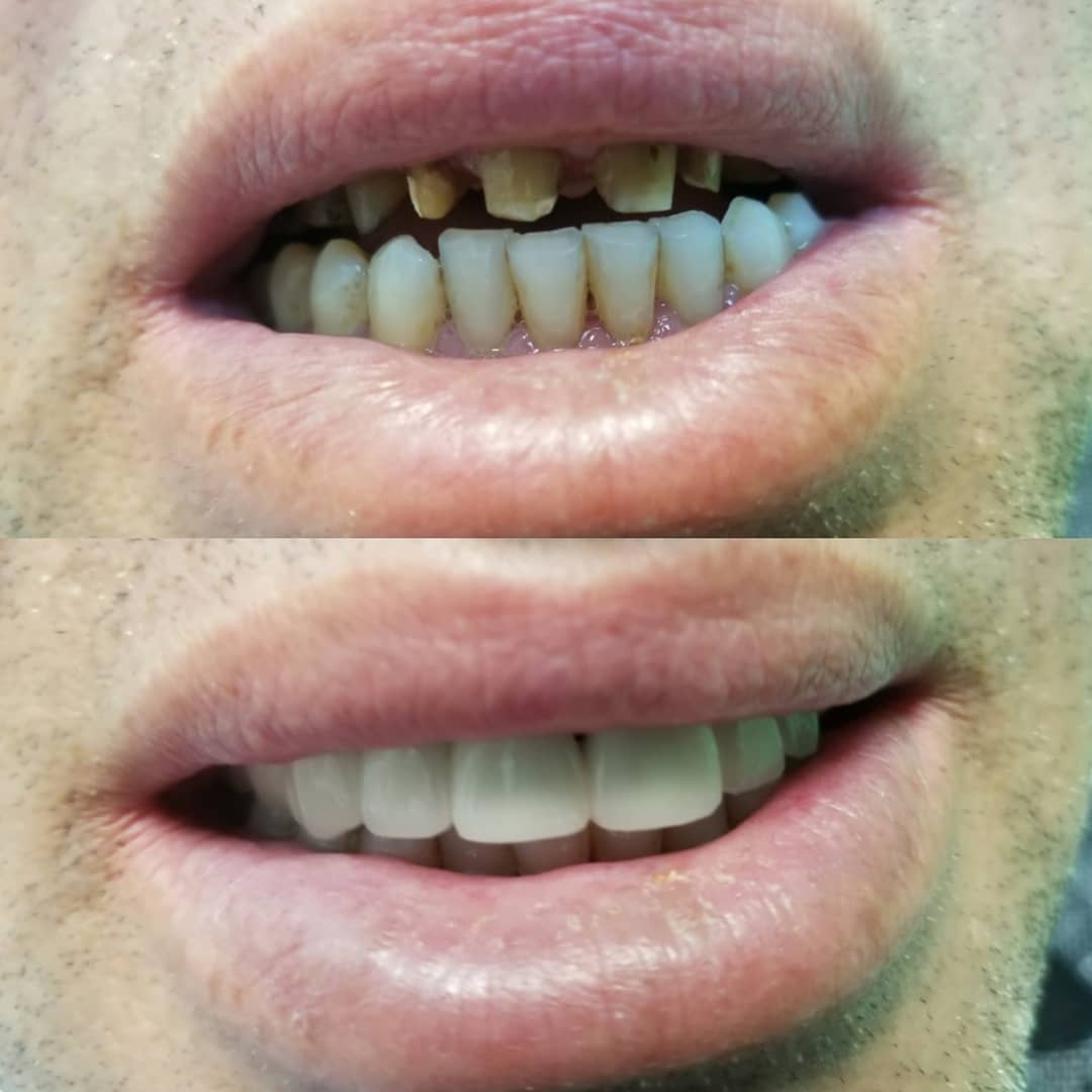 klinike-dentare-selite-19 klinike-dentare-selite-19