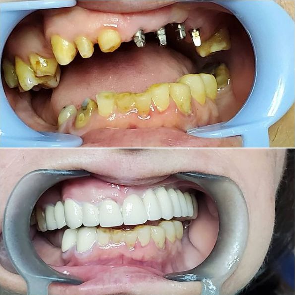 ___Klinike-dentare-shkoder-18