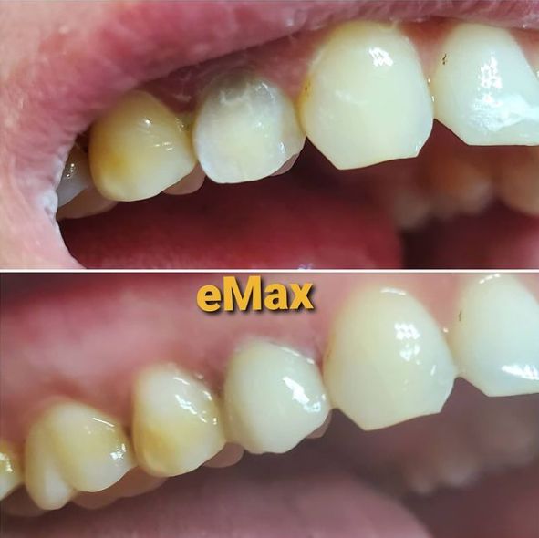 ___Klinike-dentare-shkoder-181