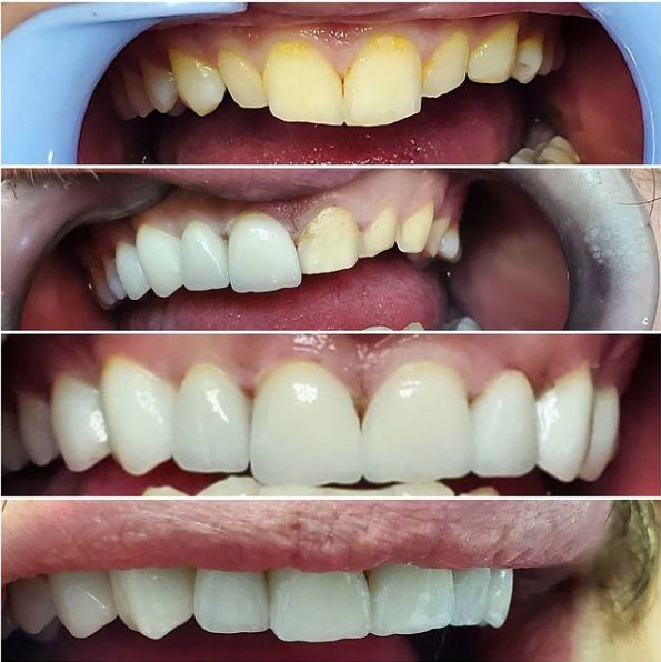 ___Klinike-dentare-shkoder-183