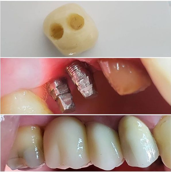 ___Klinike-dentare-shkoder-184