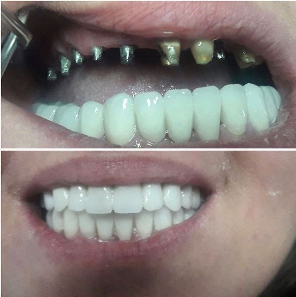 ___Klinike-dentare-shkoder-186