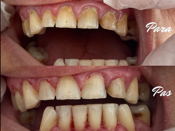 _____klinike-dentare-sarande-15
