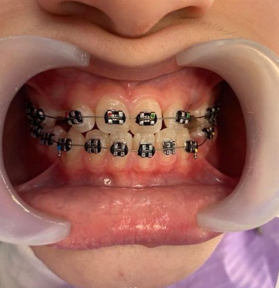 _____klinike-dentare-sarande-16