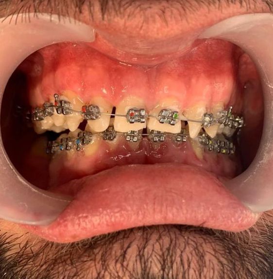 _____klinike-dentare-sarande-17