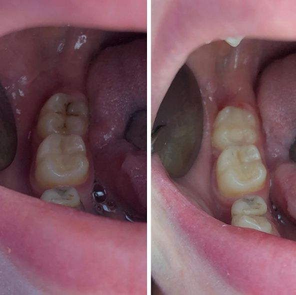 _____klinike-dentare-sarande-18