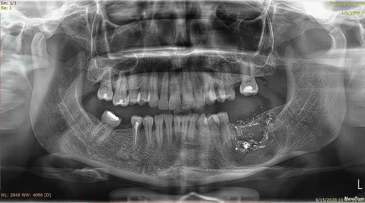 _klinike-grafi-dentare-tirane-12