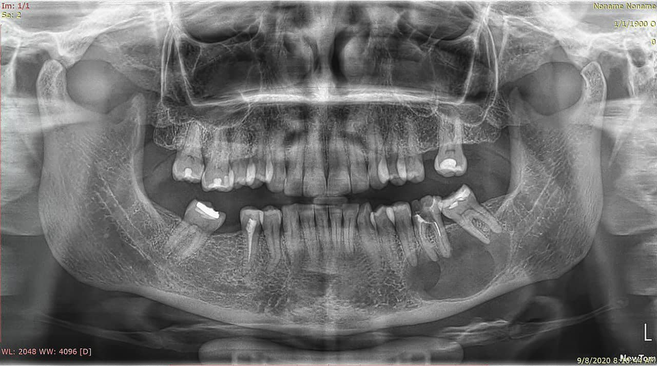 _klinike-grafi-dentare-tirane-13