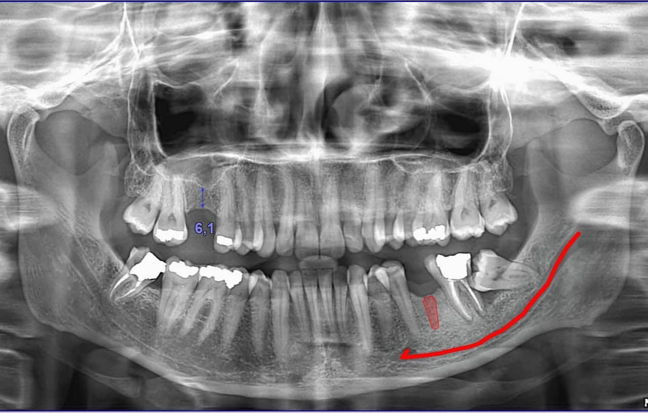 _klinike-grafi-dentare-tirane-14