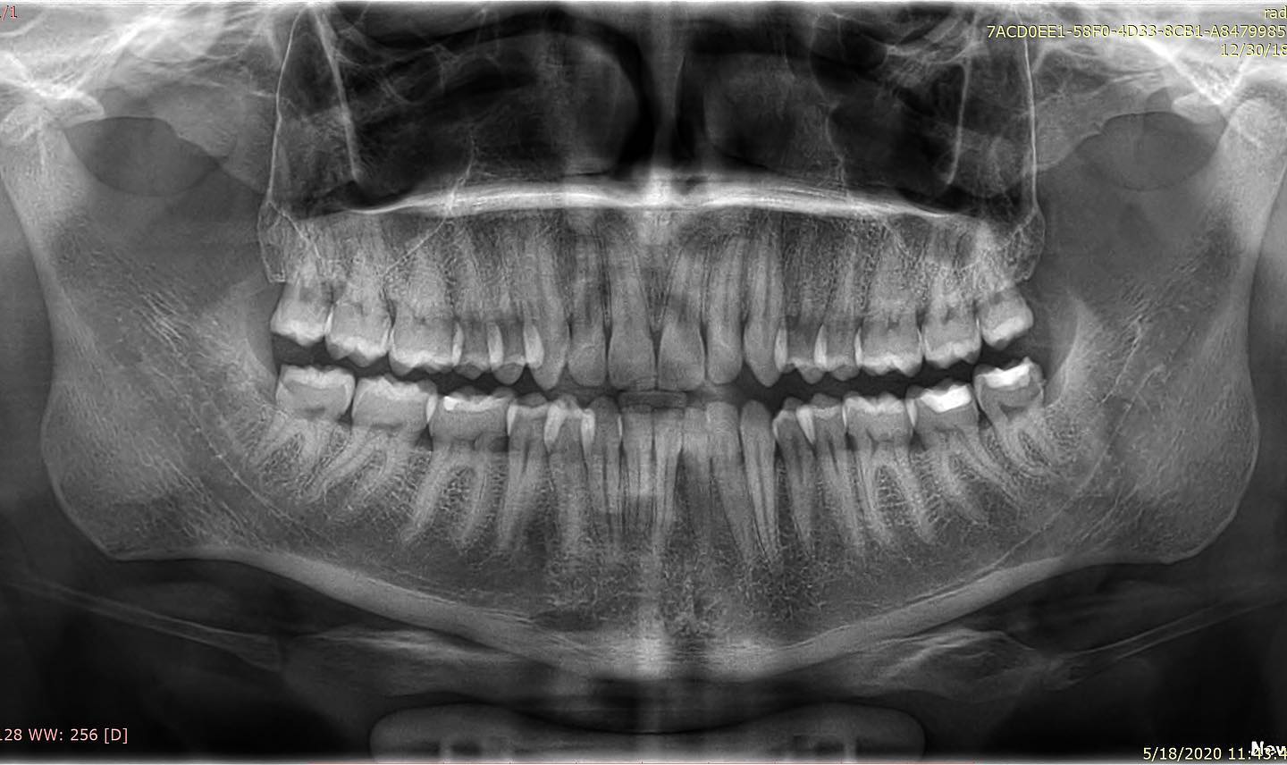 _klinike-grafi-dentare-tirane-17