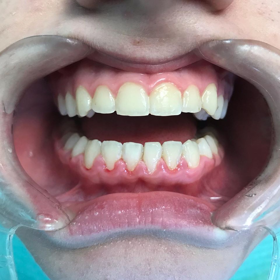 _klinike-dentare-tirane-1