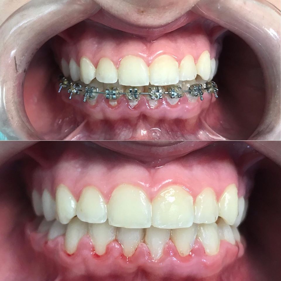 _klinike-dentare-tirane-2