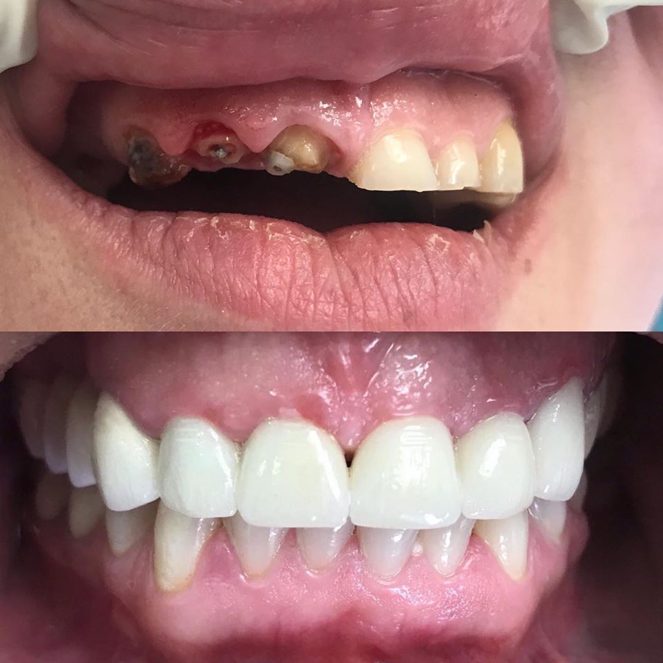 _klinike-dentare-tirane-3