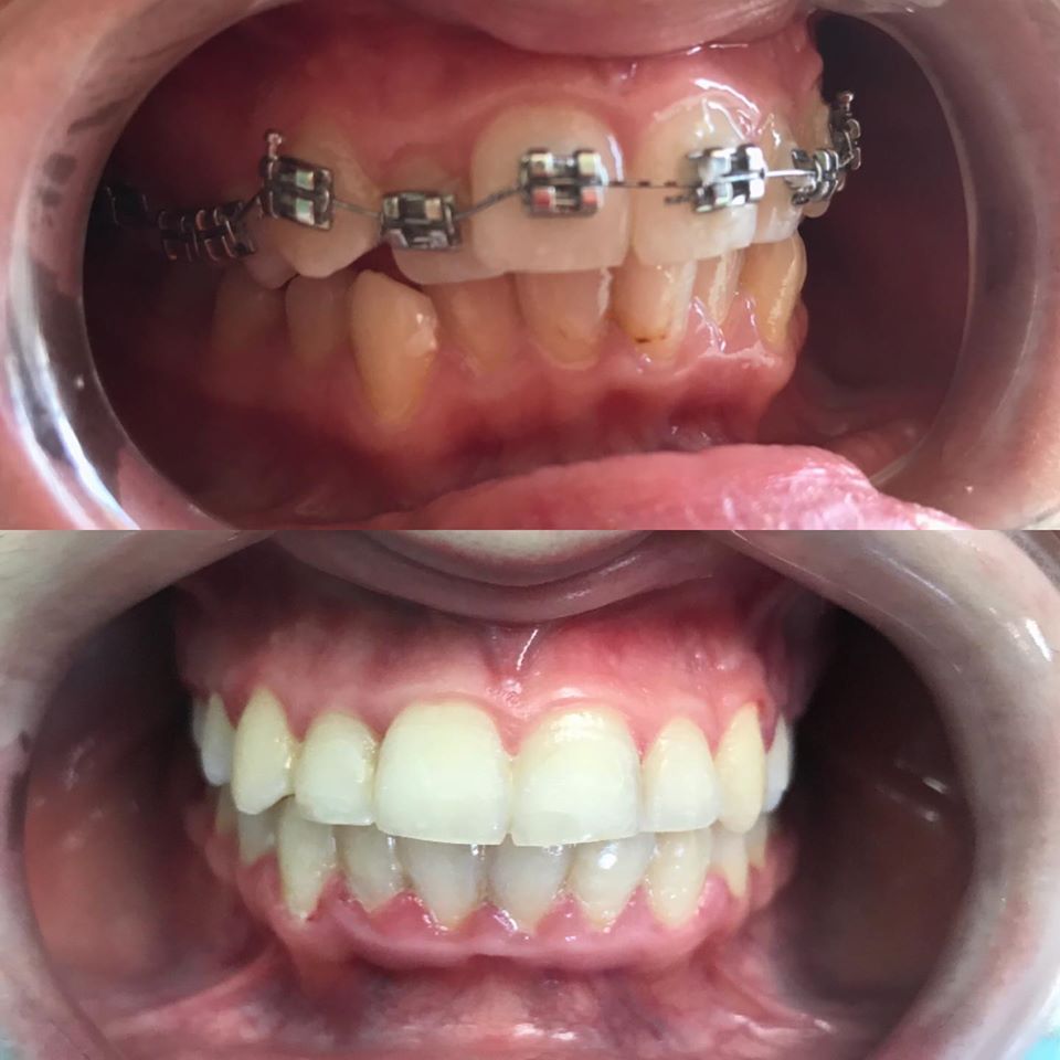 _klinike-dentare-tirane-4