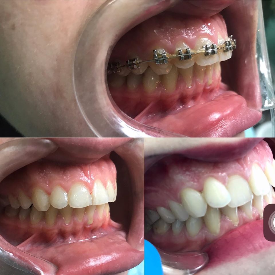 _klinike-dentare-tirane-5