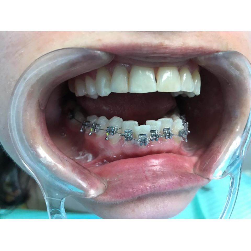 _klinike-dentare-tirane-6